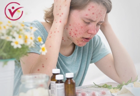 У человека аллергия